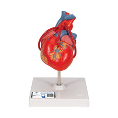 Classic Heart with Bypass, 2 part