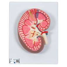 Human Kidney Section Model, 3x full-size