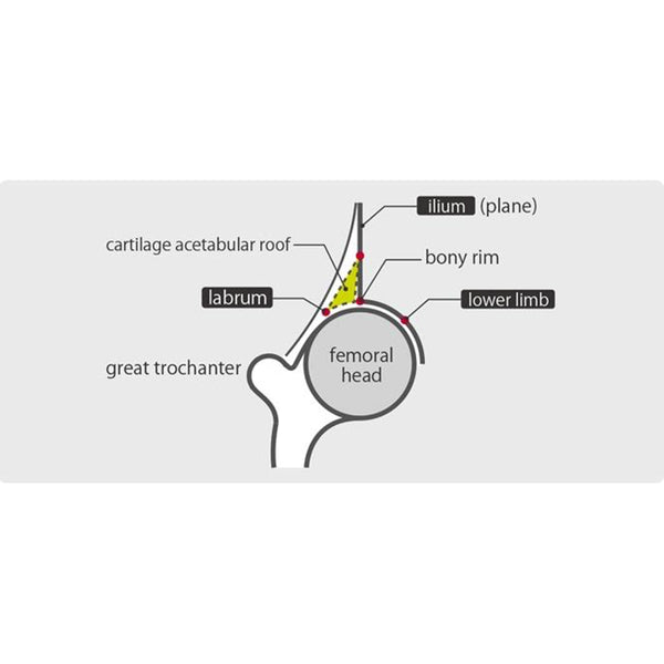 健康・医学 Taro Schiller TMX-428 Stress Test Treadmill - Save at — Tiger Medical