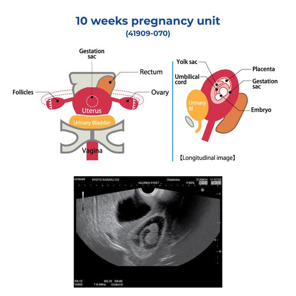 10 Weeks Pregnancy Unit – GTSimulators.com