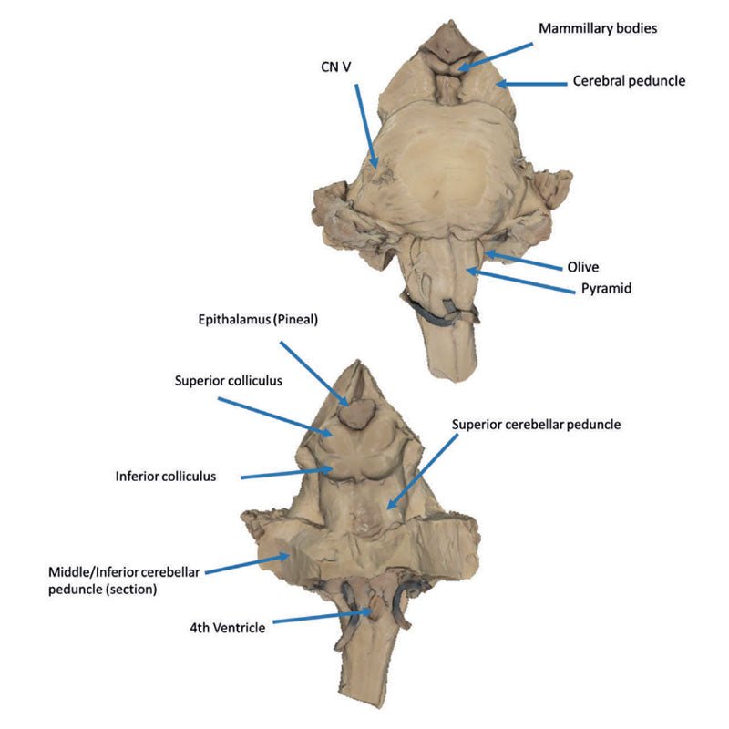 3D Printed Brain Stem, Isolated Anatomy From Midbrain to Medulla Oblongata