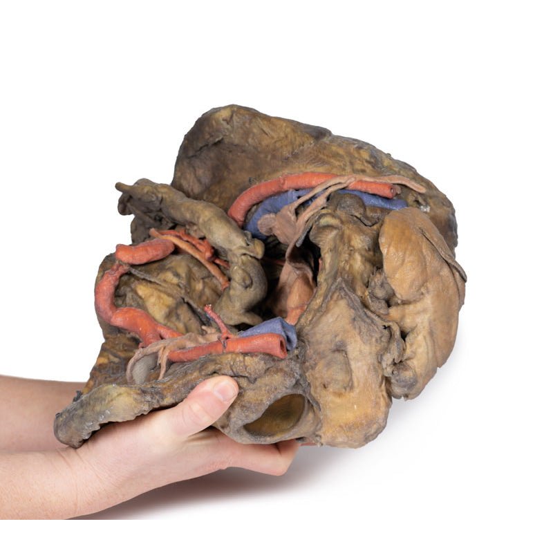 3D Printed Female Pelvis Deep Dissection