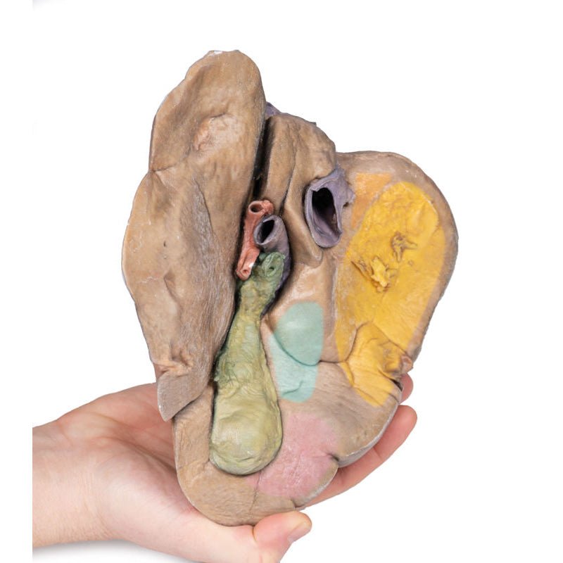 3D Printed Liver with Vessels and Gallbladder