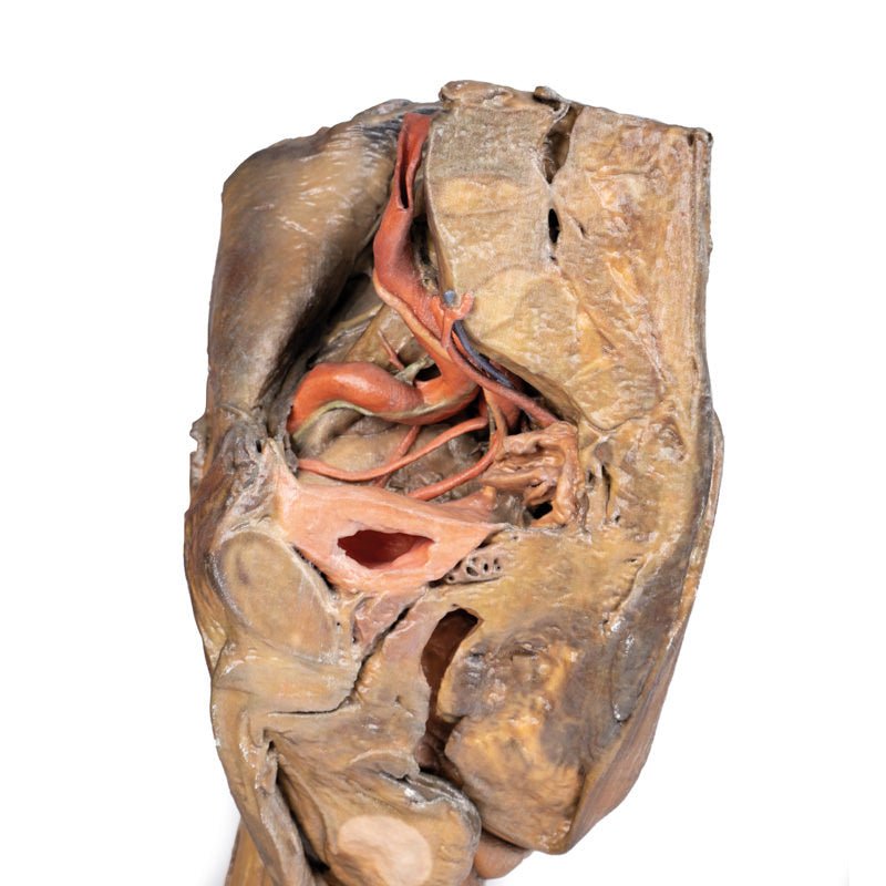3D Printed Male Hemipelvis and Thigh