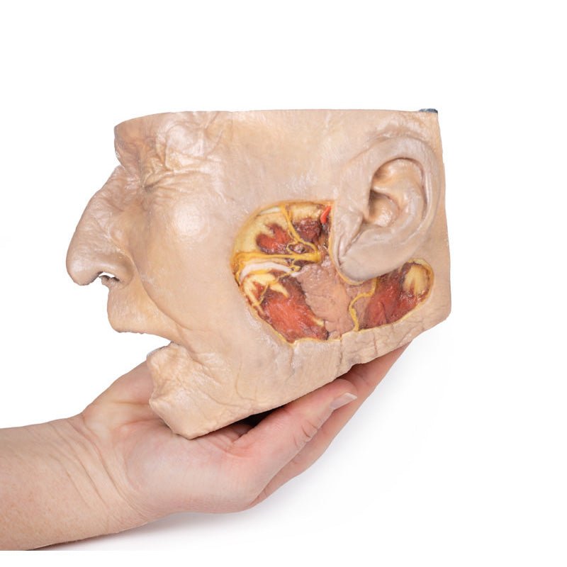 3D Printed Parotid Gland and Facial Nerve Dissection