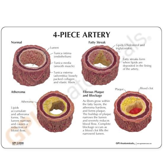 4-pc Artery Model