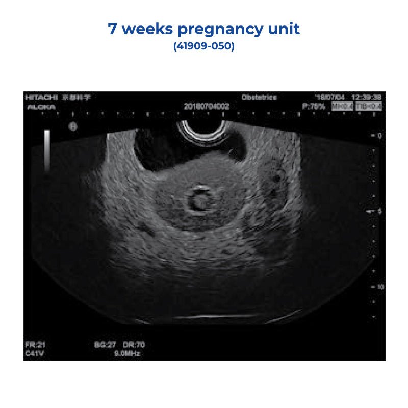 7 Weeks Pregnancy Unit