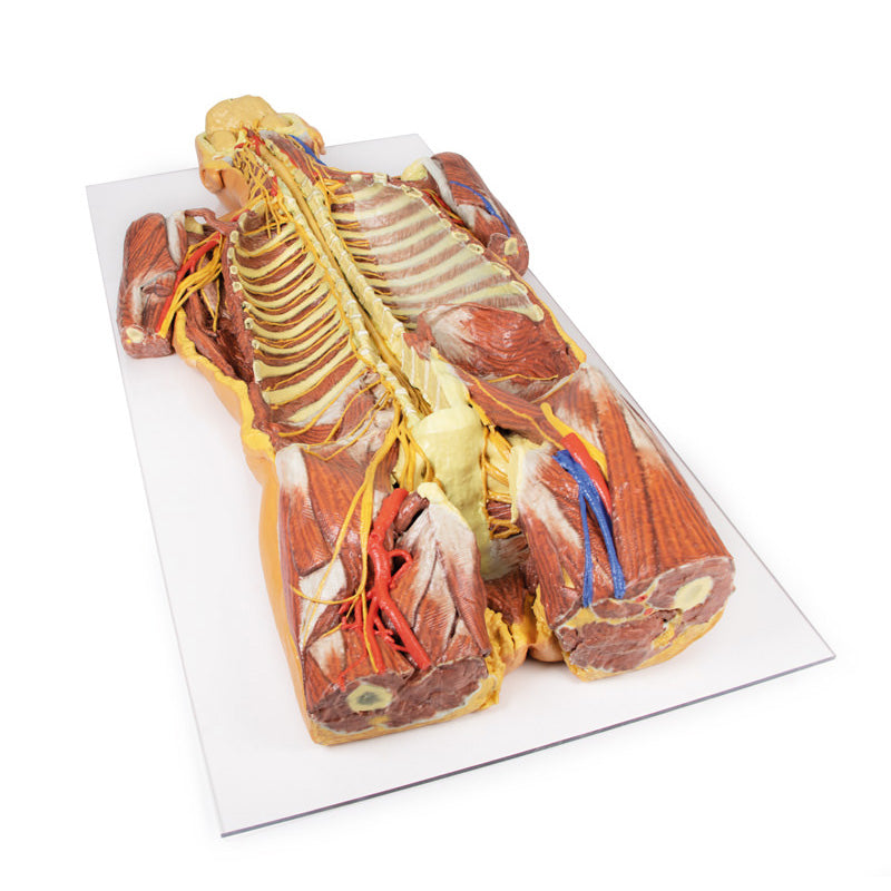3D Printed Posterior Body Wall - Ventral Deep Dissection