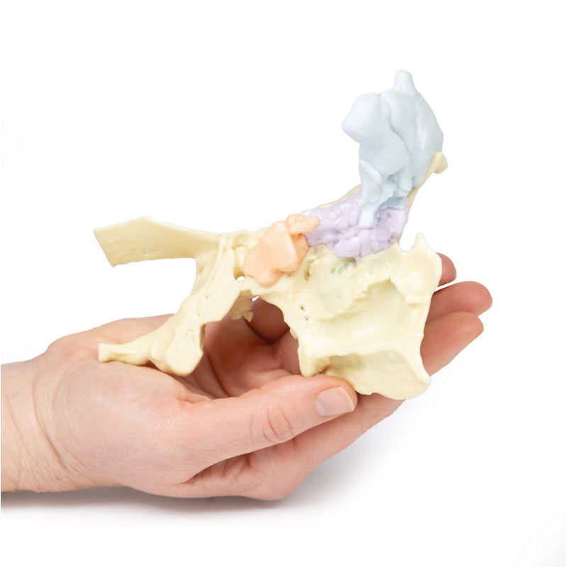 3D Printed Paranasal Sinus Model
