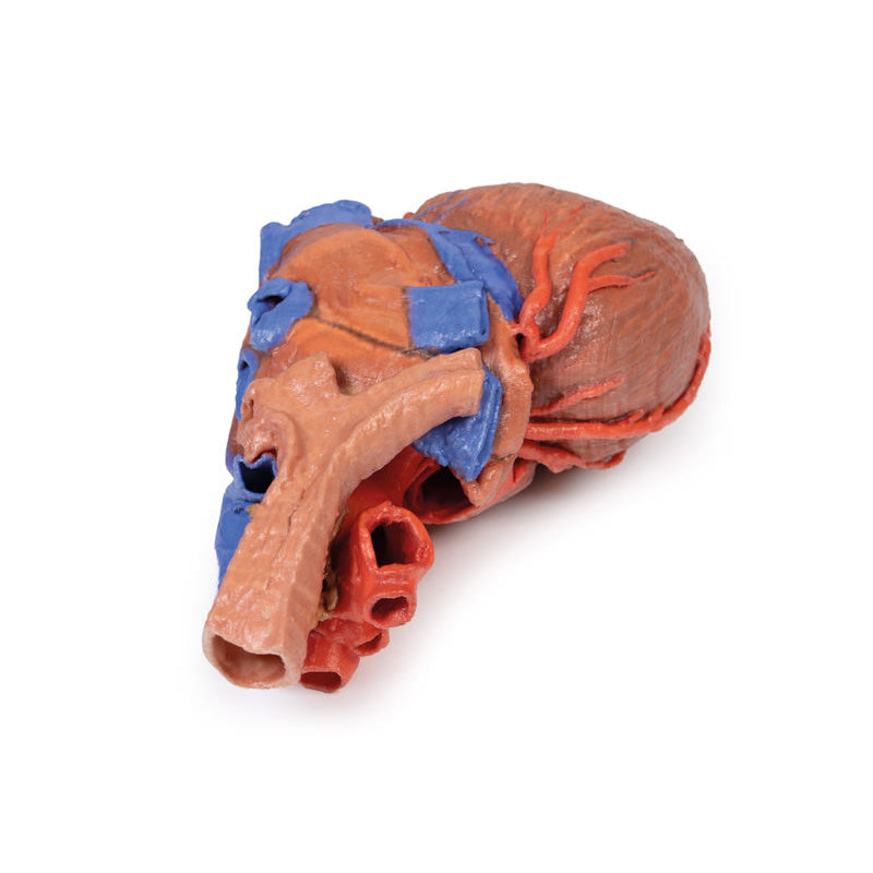 3D Printed Heart and the distal trachea, carina and primary bronchi