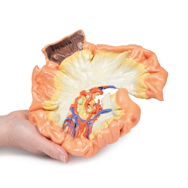 3D Printed Bowel - Portion of Jejenum Model