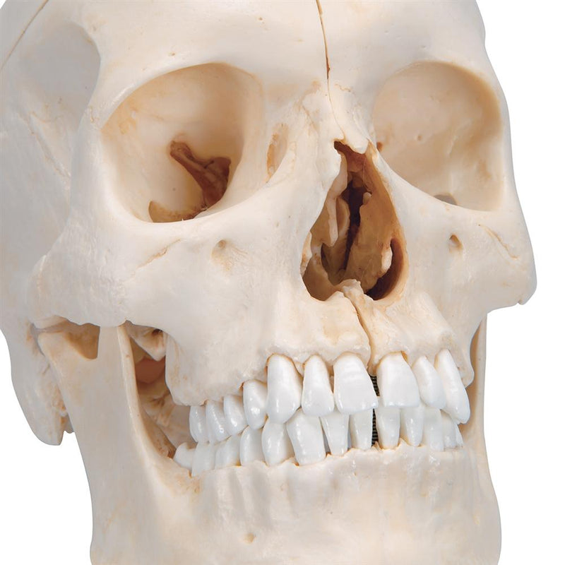 BONElike™ Human Bony Skull Model, 6 part