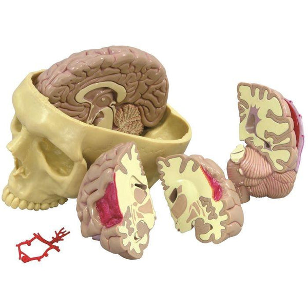 brain-model-and-partial-skull-