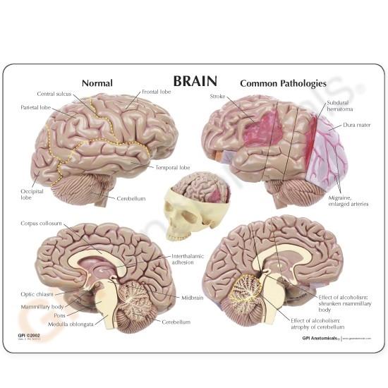 Brain Model and Partial Skull