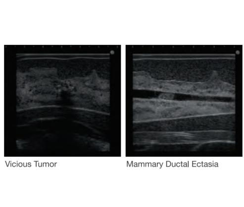 Breast Ultrasound Exam Phantom 'BREAST FAN'