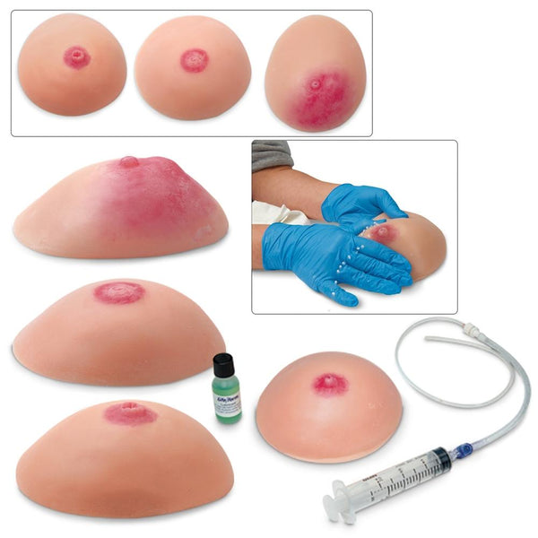 Common Breast Conditions, Set of 4 Common Breast Conditions, Set of 4