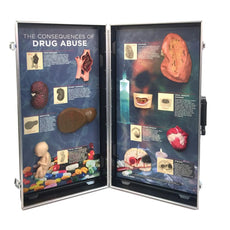 Drug Abuse Consequences 3D Display