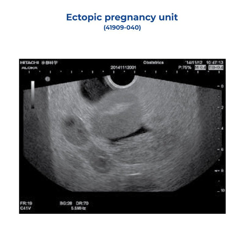 Ectopic Pregnancy Unit