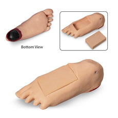Edema Foot With Tissue Injury for GERi™-KERi™, Light Skin