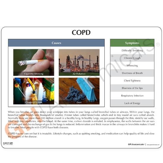 Enlarged COPD 4-piece Model