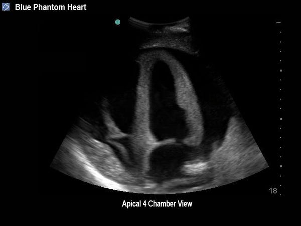 FAST Exam Real Time Ultrasound Training Model, Transthoracic Only ...