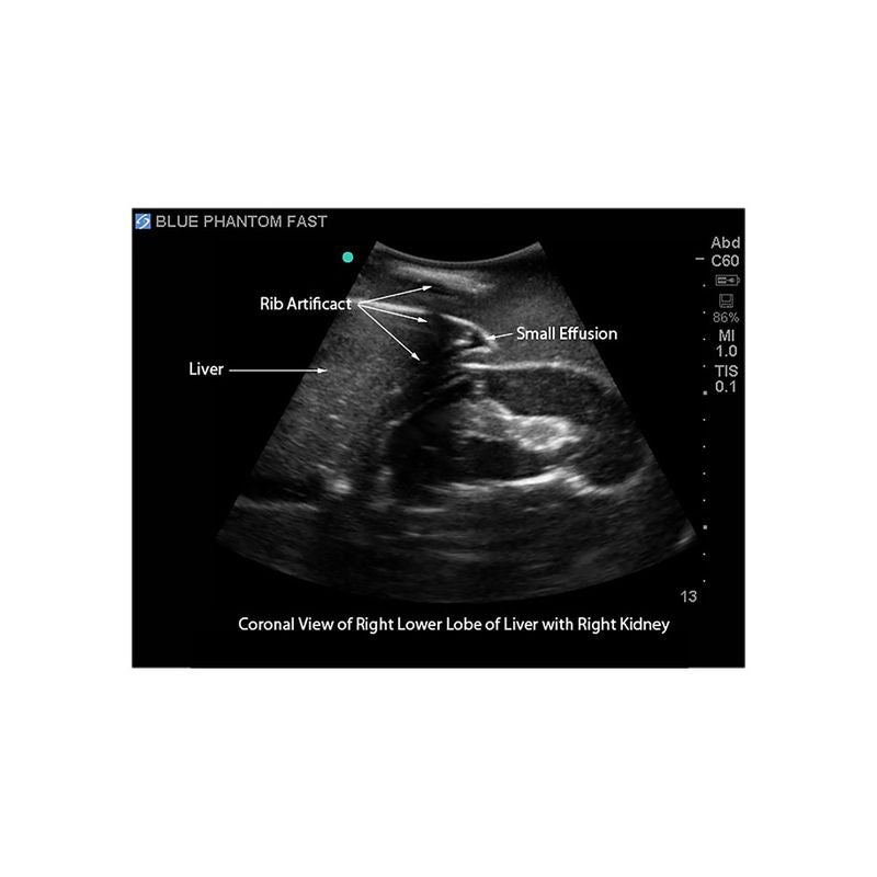 FAST Exam Ultrasound Training Model, Transthoracic and Transesophageal