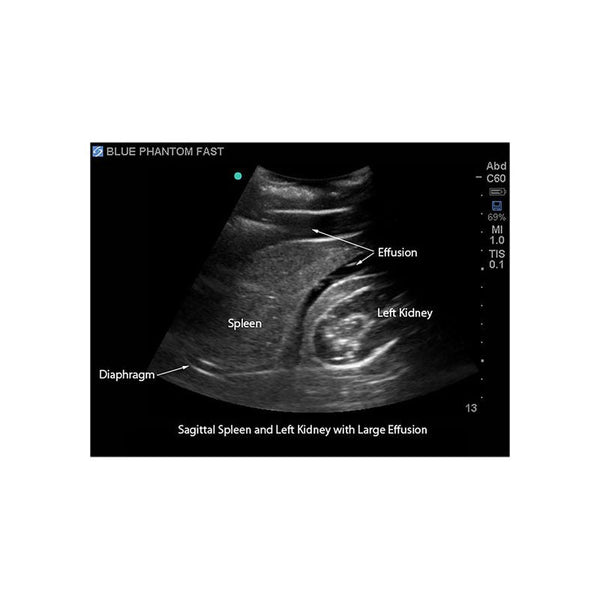 FAST Exam Ultrasound Training Model, Transthoracic and Transesophageal ...