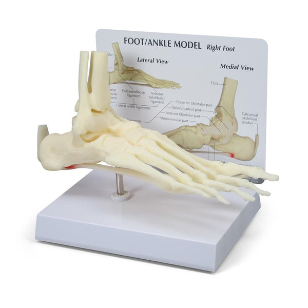 Foot-Ankle Model with Plantar Fasciitis – - Main Image