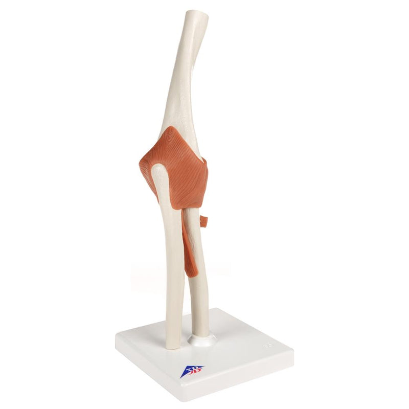 Functional Elbow Joint Model