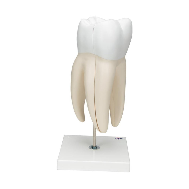 Giant Molar with Cavities, 15x life size, 5 part