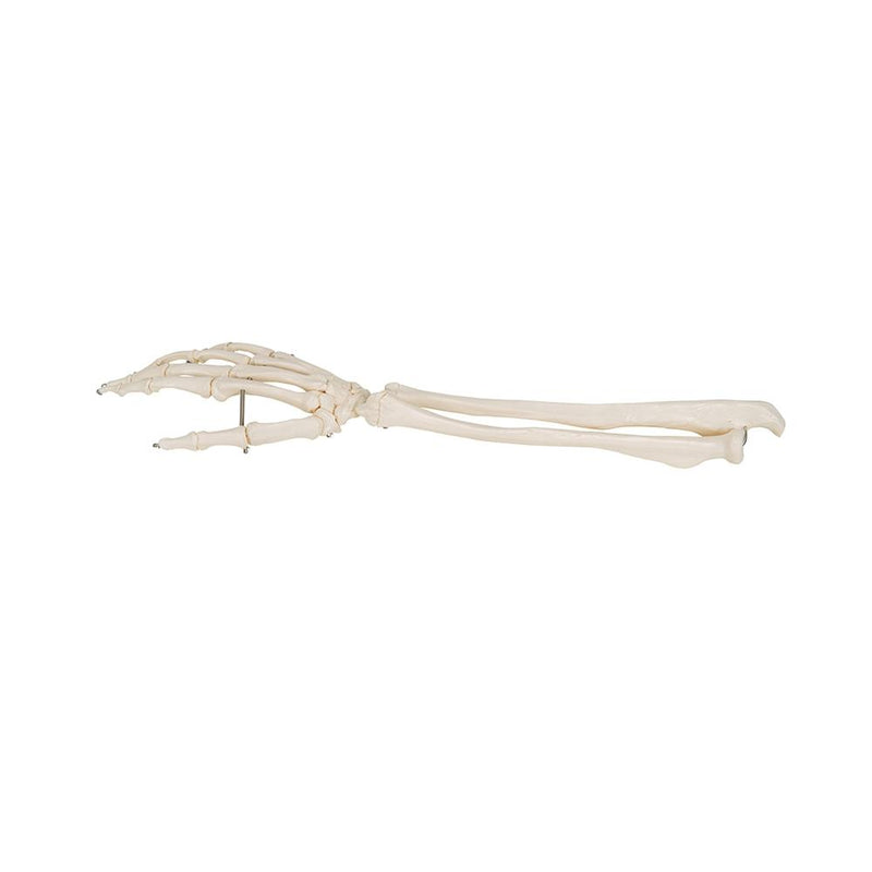 Hand Skeleton with portions of ulna and radius