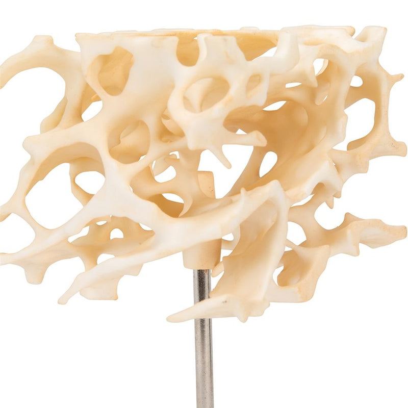 Human Cancellous Bone Model, Enlarged 100 Times