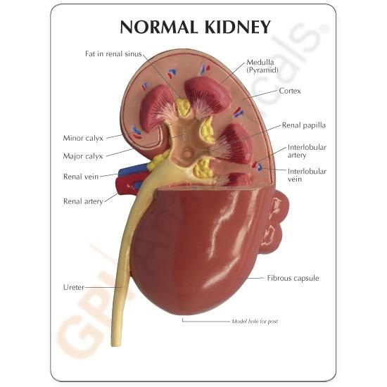 Kidney Model (oversize) with Pathologies