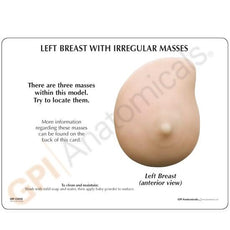 Left Breast Cancer Model, Life-like