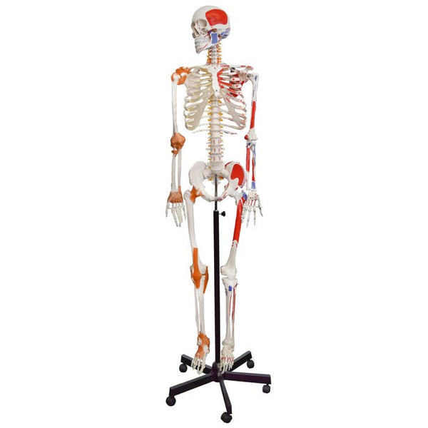 Evotech Scientific Human Foot & Ankle Skeleton Model – Life Size, Articulated With Muscle Origins Painted
