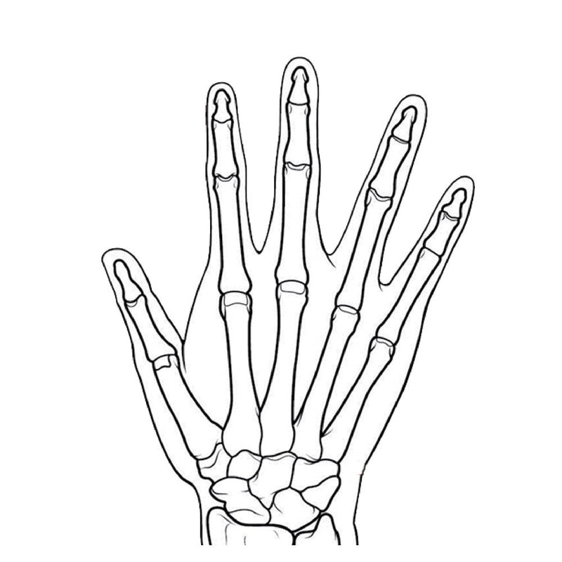 Rheumatoid Hand Phantom