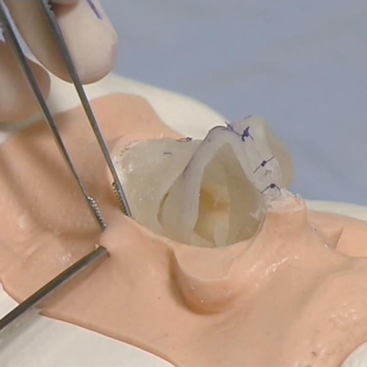 Rhinoplasty Surgical Training Simulator