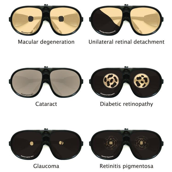simulation goggles Simulation of eye diseases
