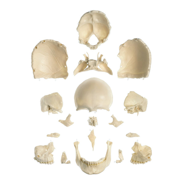 SOMSO 18-Part Model of the Skull – GTSimulators.com