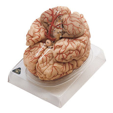 SOMSO Brain Model with Arteries
