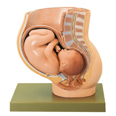 SOMSO Pelvis with Uterus in Ninth Month of Pregnancy