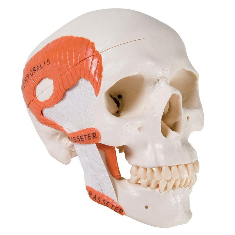 TMJ Skull with masticator muscles, 2 part