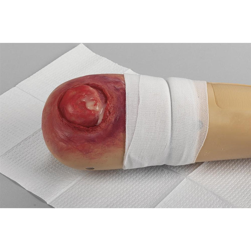 Ultra Nursing Wound Simulation Kit