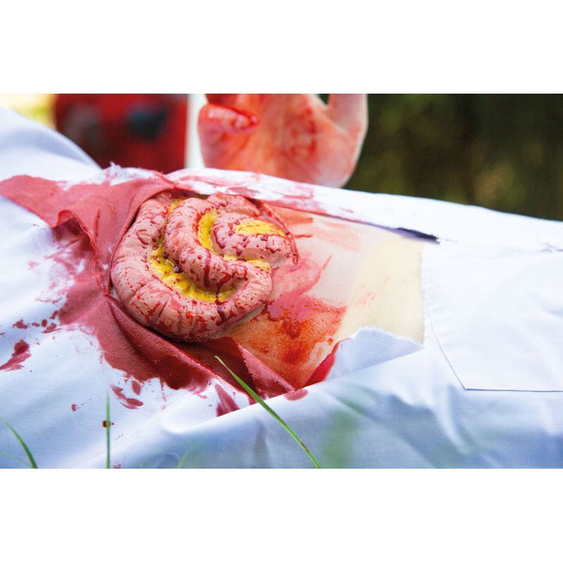 Wound Moulage Protruding of small and large intestines