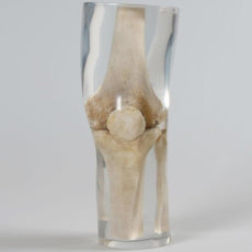 X-Ray Phantom Knee, Transparent