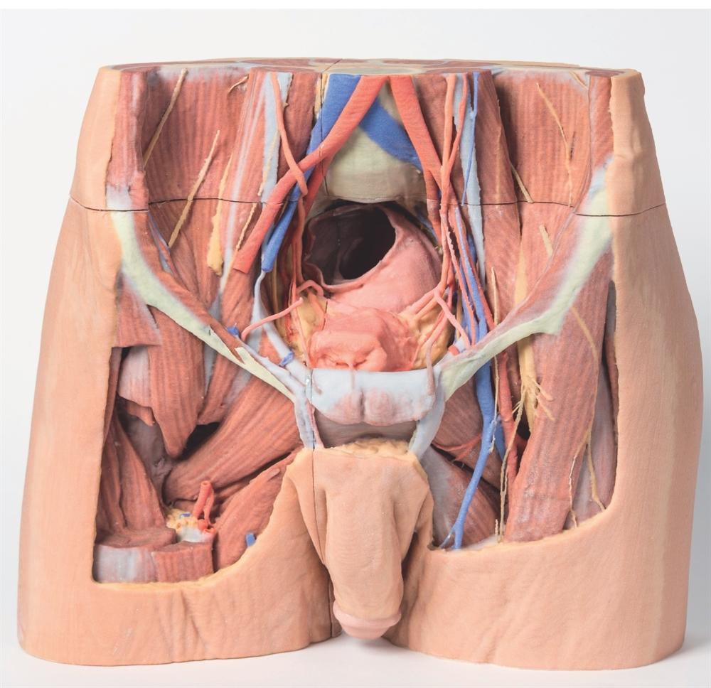 1. 3D Printed Human Pelvis Models