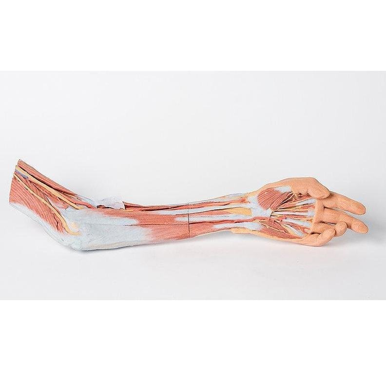 1. 3D Printed Upper Limb Models