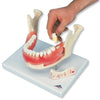 1. Dental Pathology Models