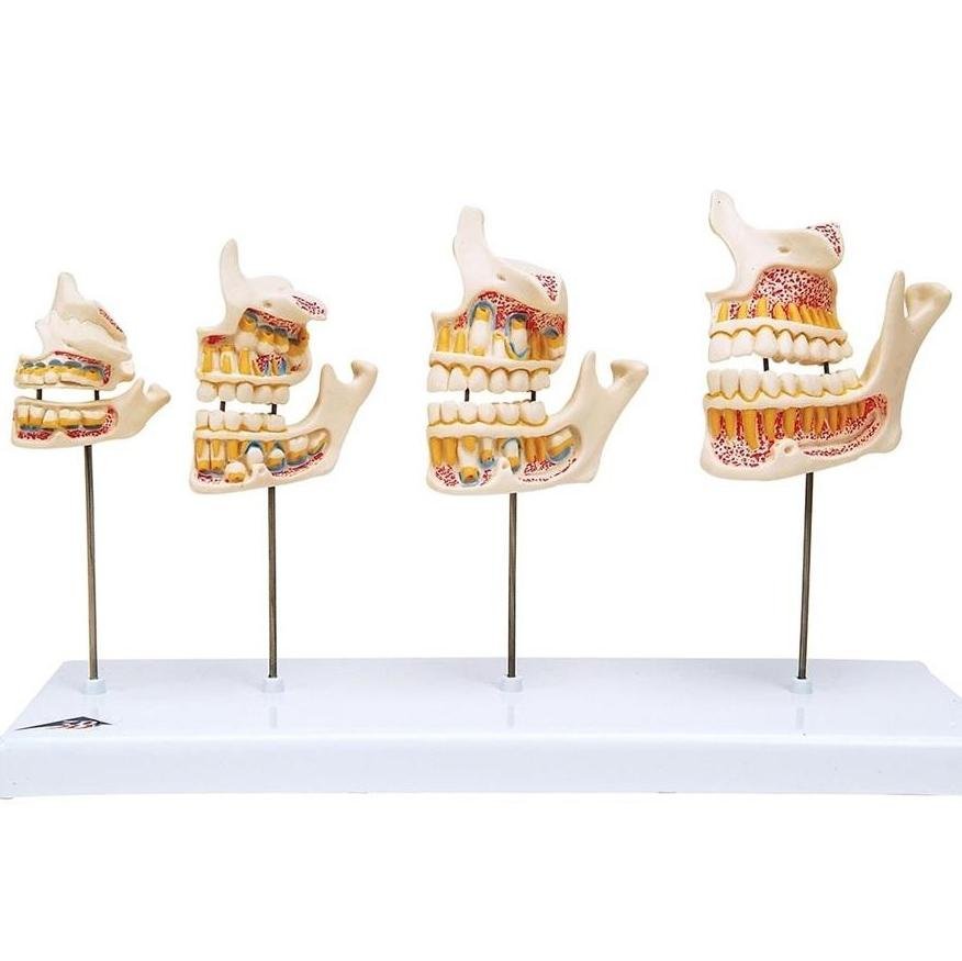 1. Dentition Development Models