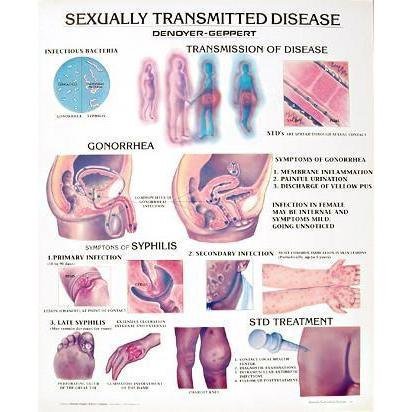 1. Disease Charts